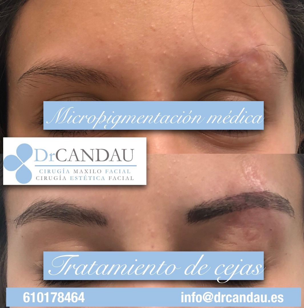 Alberto Candau Álvarez-30