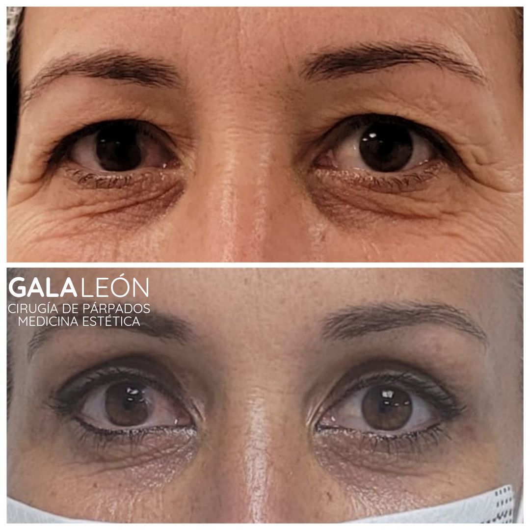 Gala P. Leon Salvatierra-12