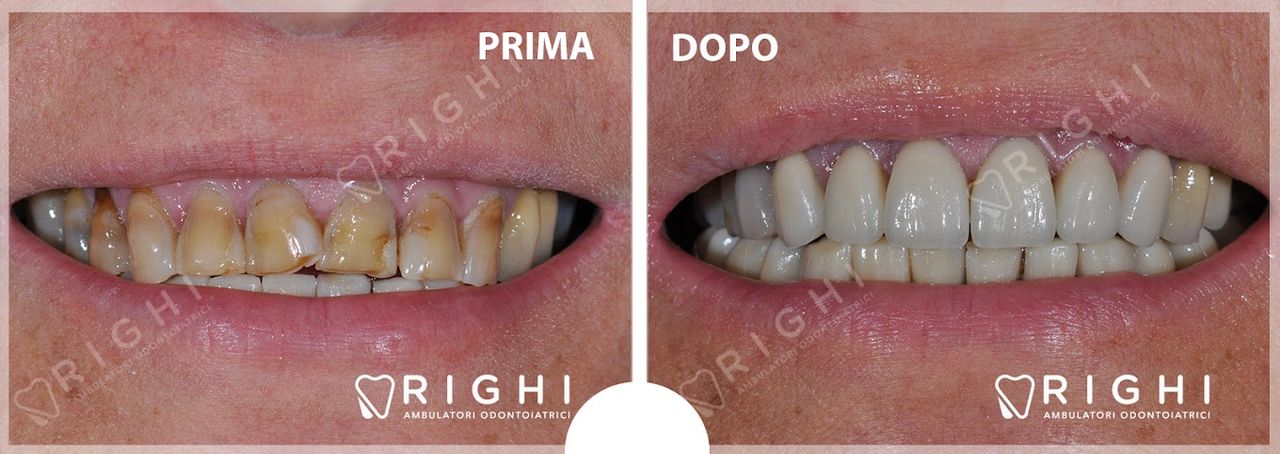 Donato Dilan Tata-11