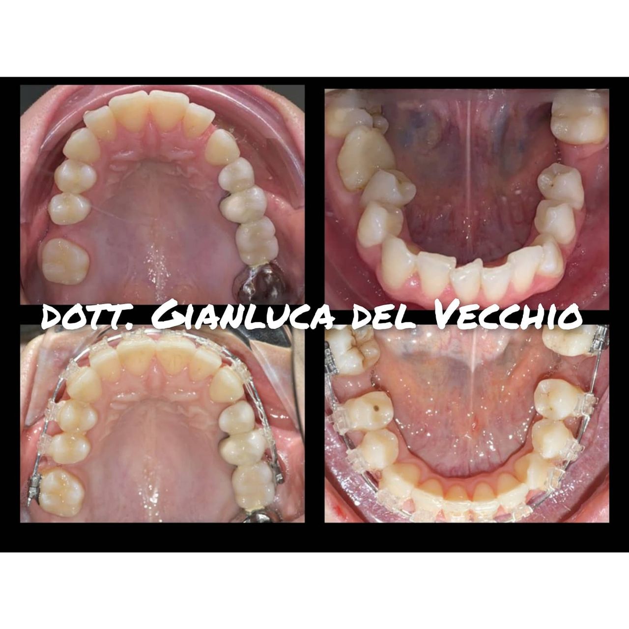 Gianluca Del Vecchio-77