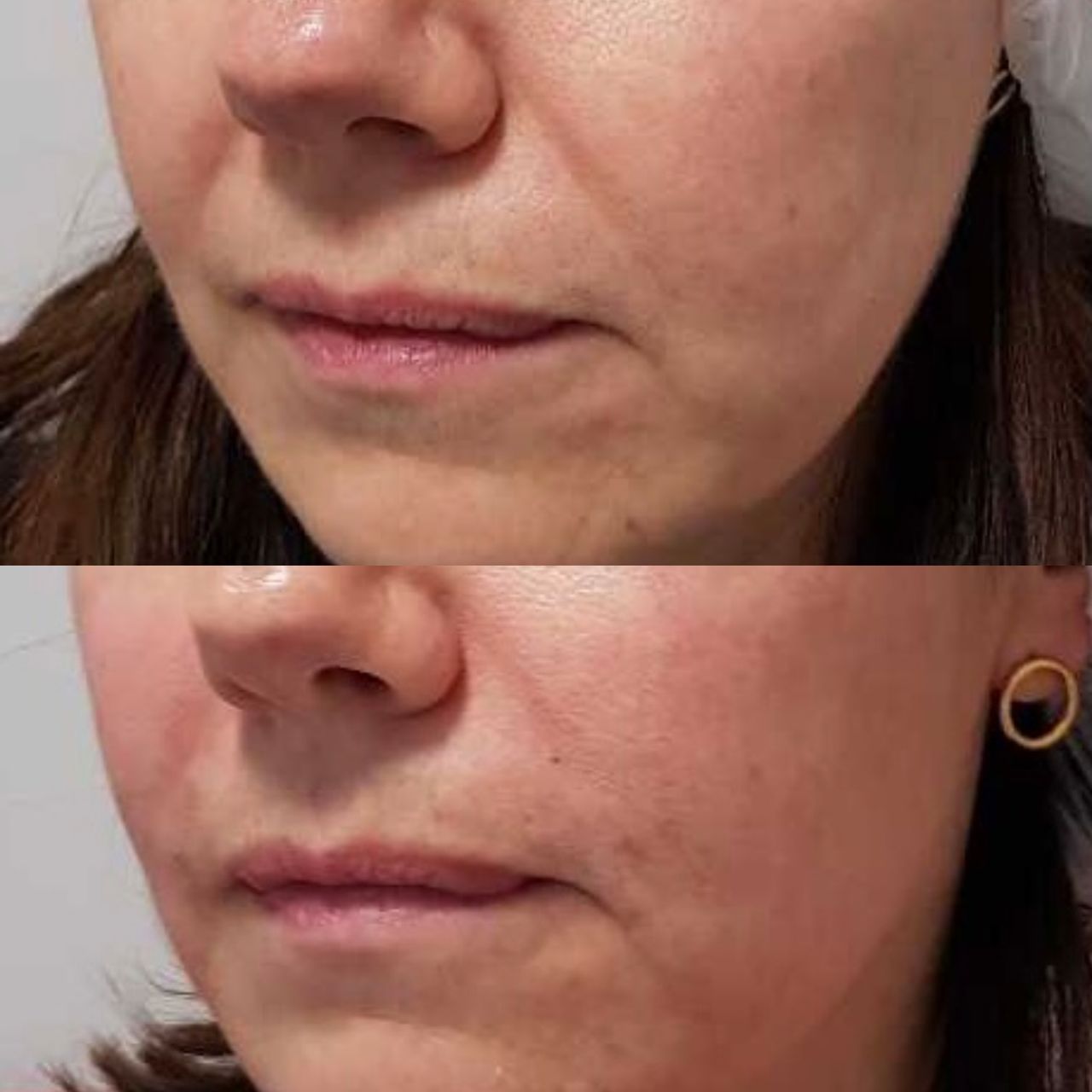 Rosalba Herrero Zerpa-310