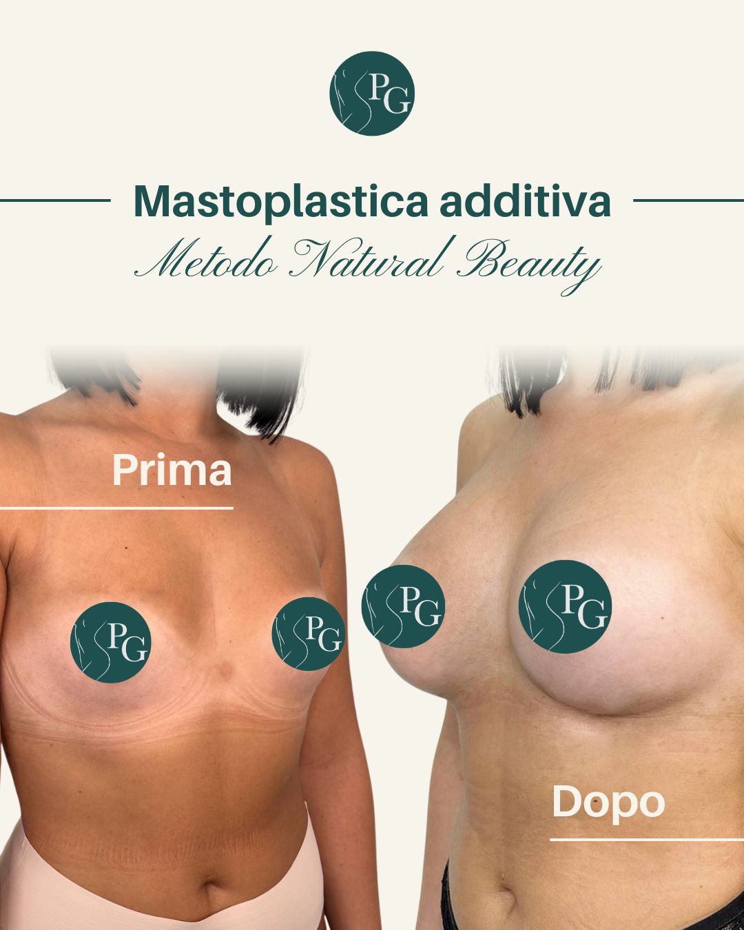 Pasquale Graziano-20