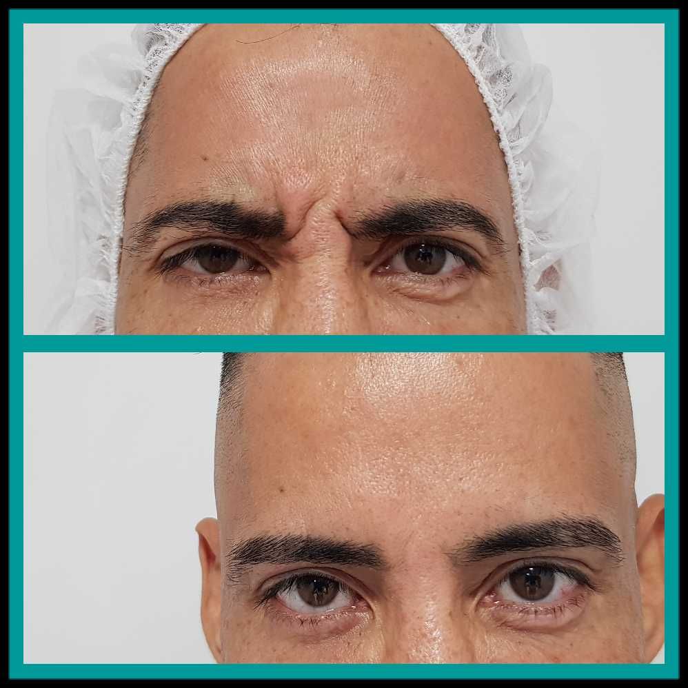 Rosalba Herrero Zerpa-339