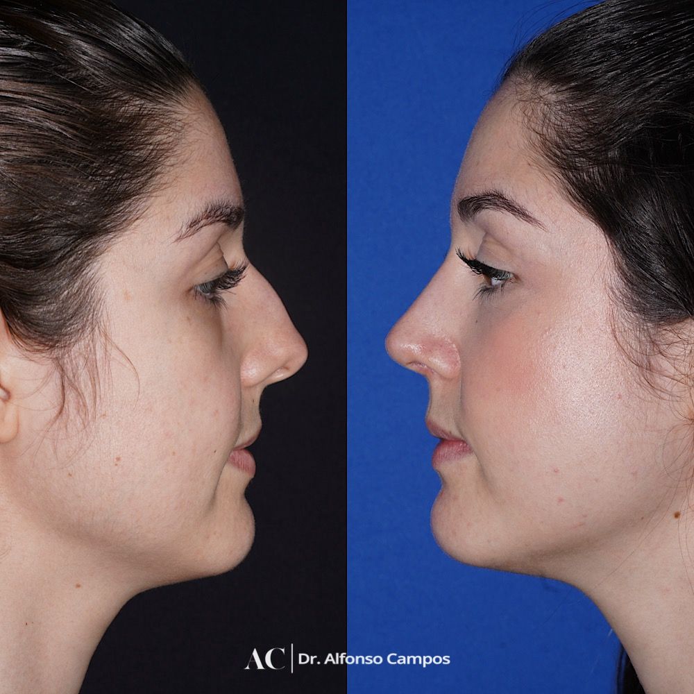 Alfonso Campos Gonzalez-6