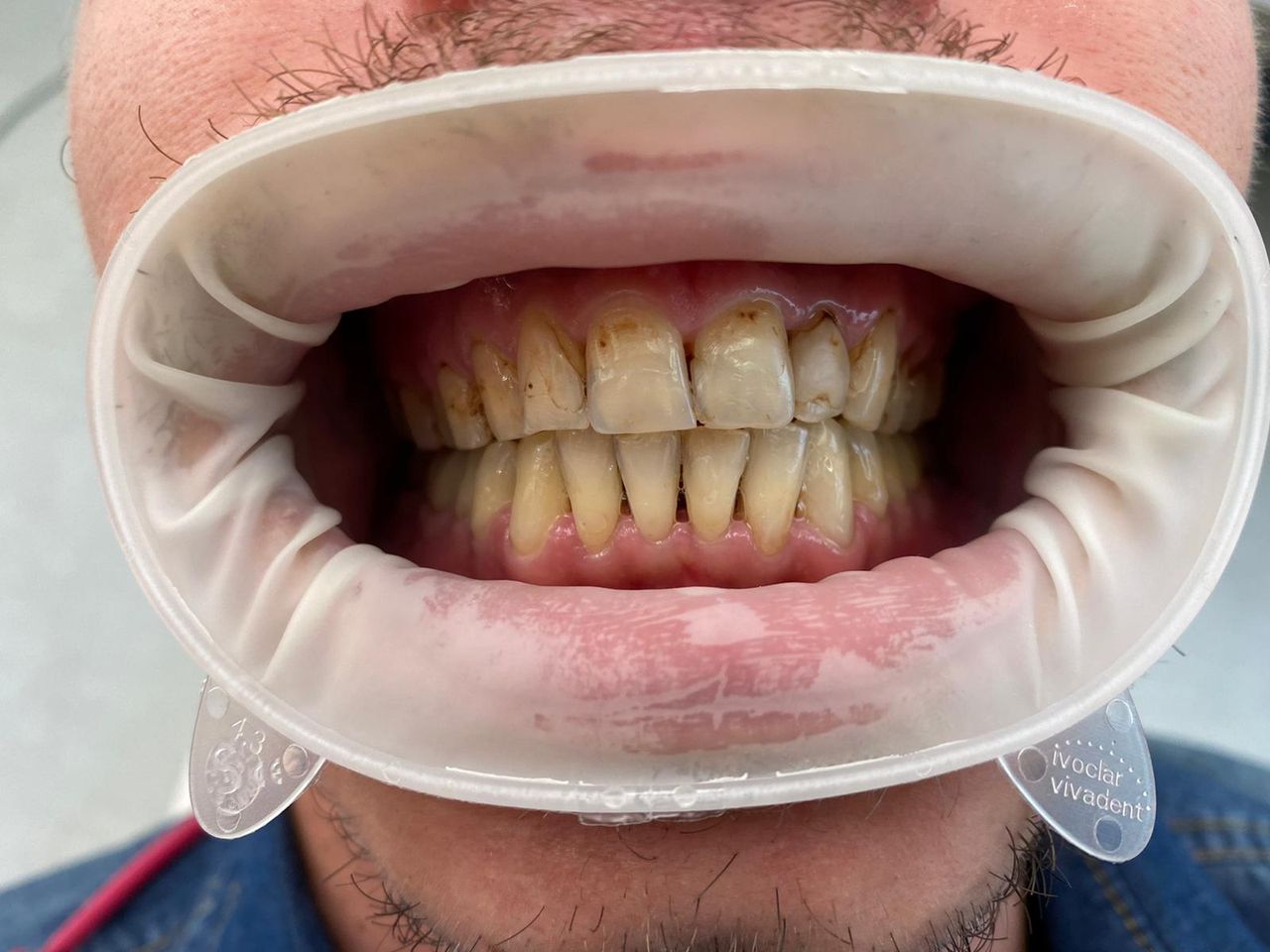 Giampiero Piccione-8