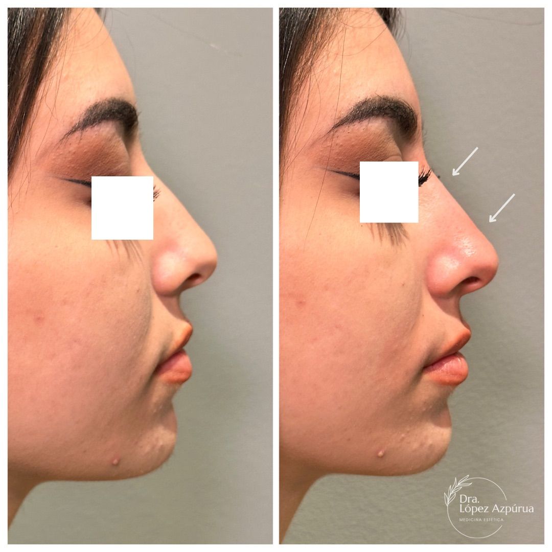 Alexandra López Azpúrua-10