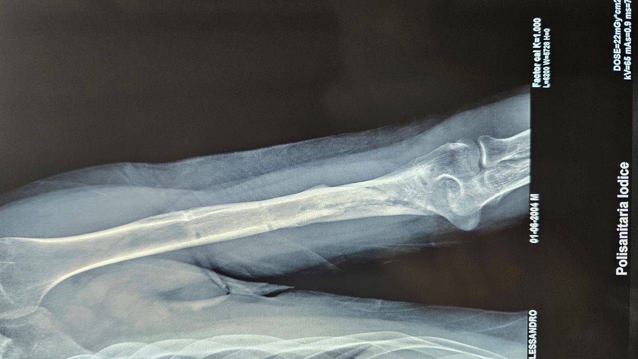 Gennaro Campopiano-10