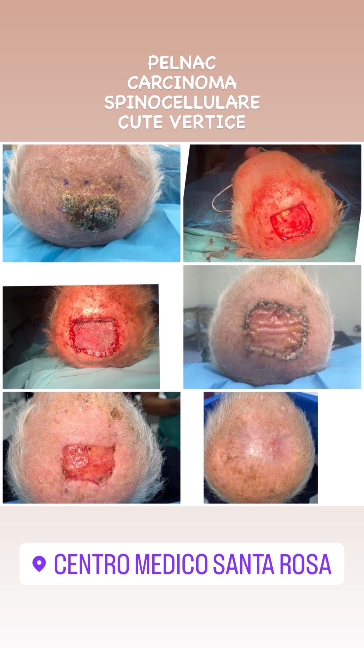 Maurizio Perugini-21