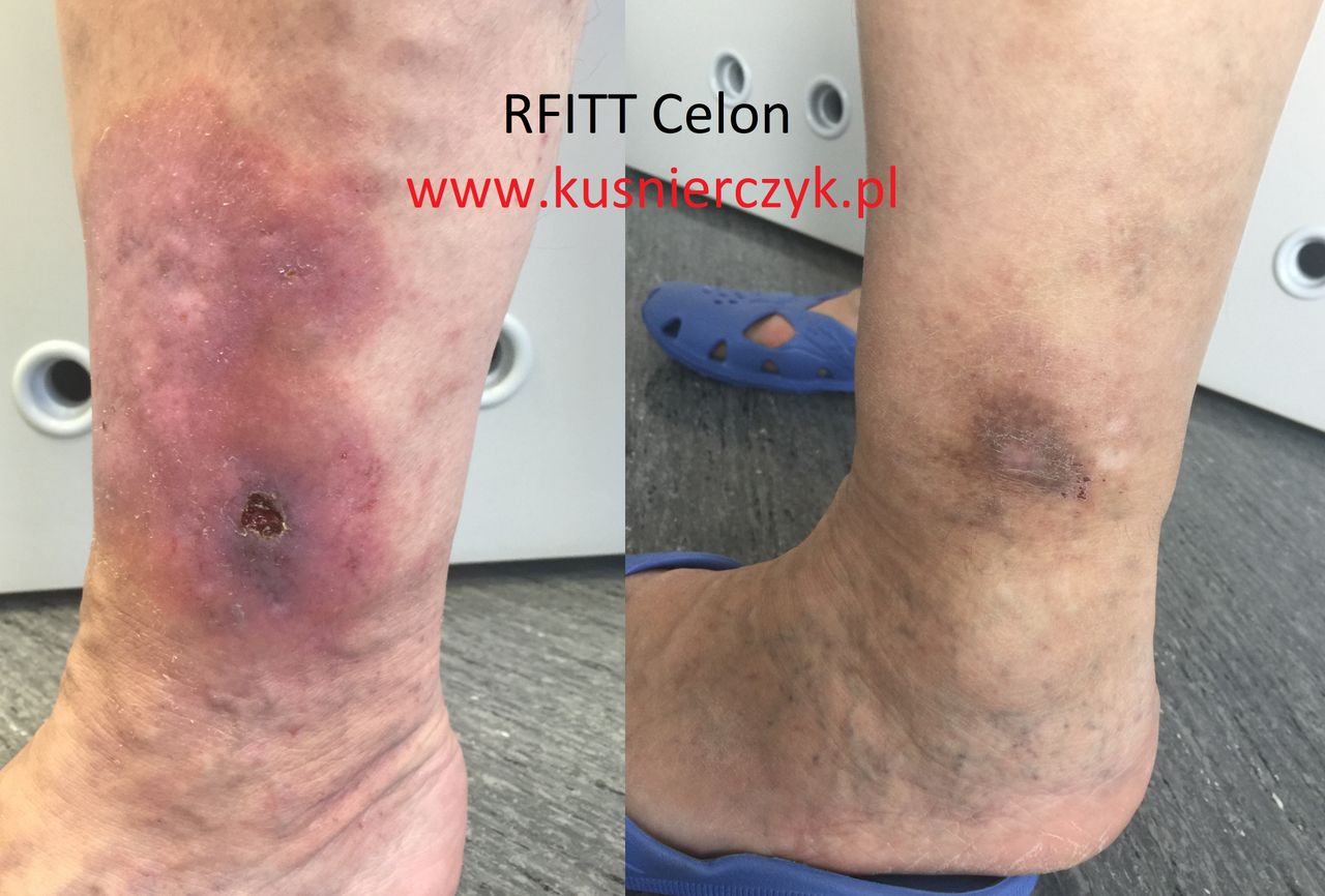 Roman Kuśnierczyk-6