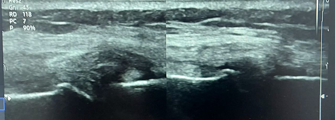 Álvaro Cerezuela Sánchez-9