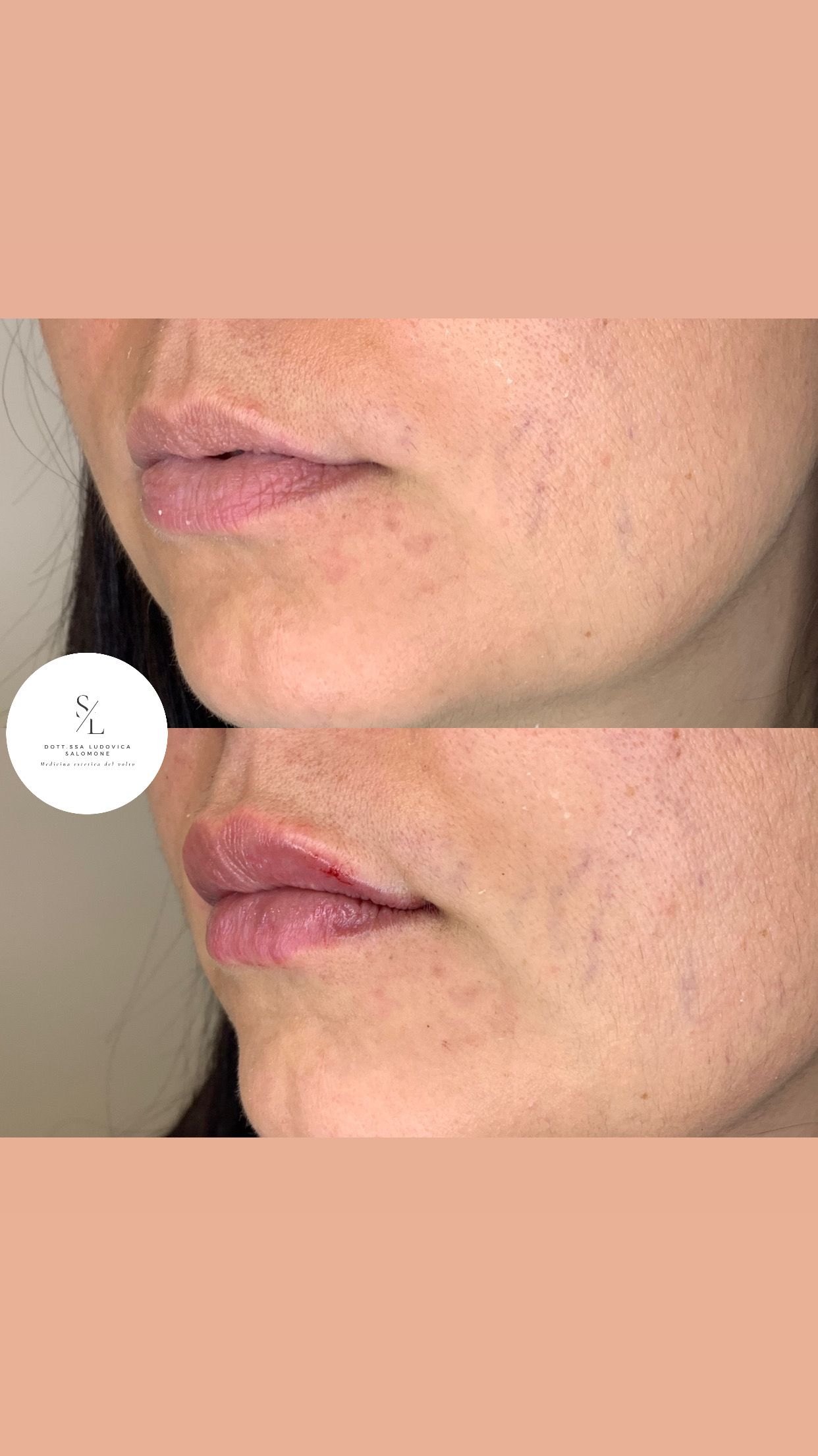 Ludovica Salomone-13