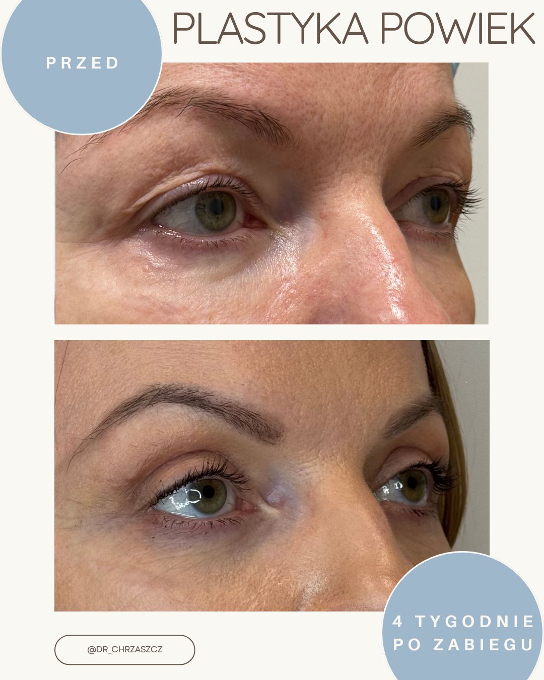 Michał Chrząszcz-0