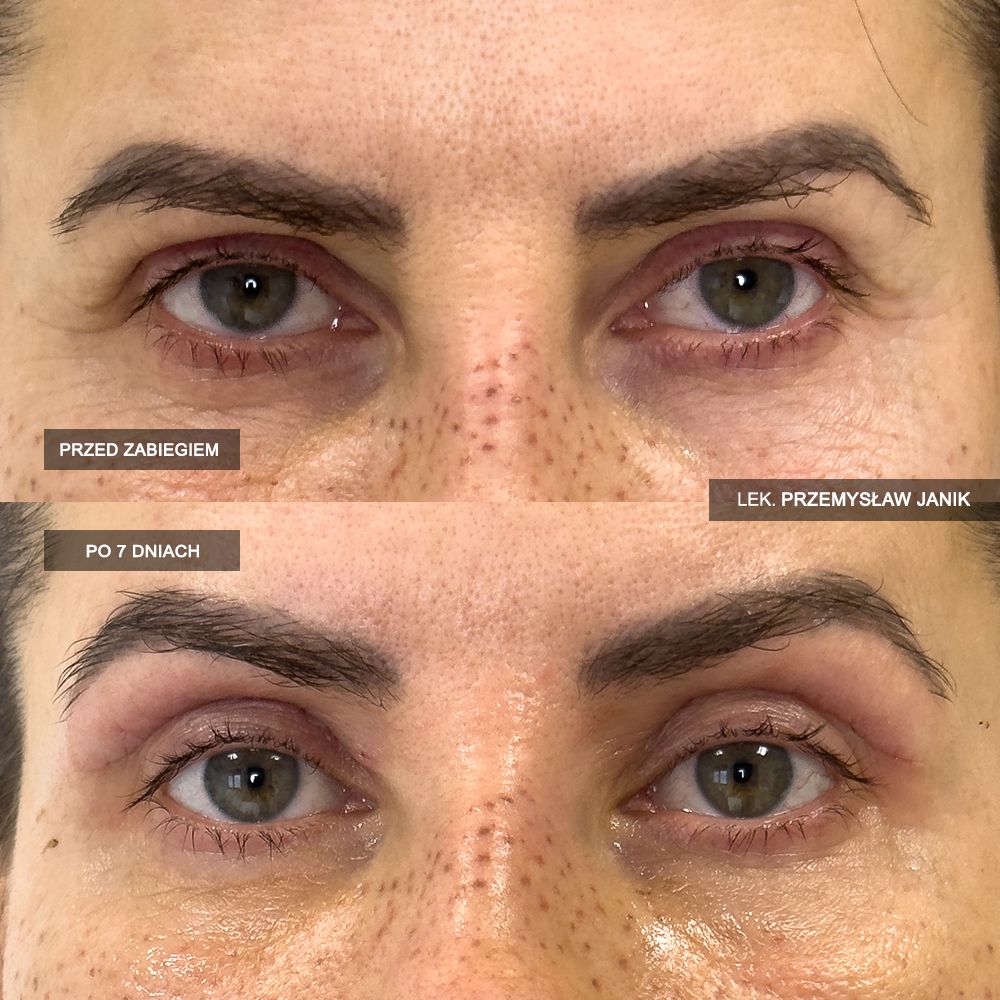 Przemysław Janik-23