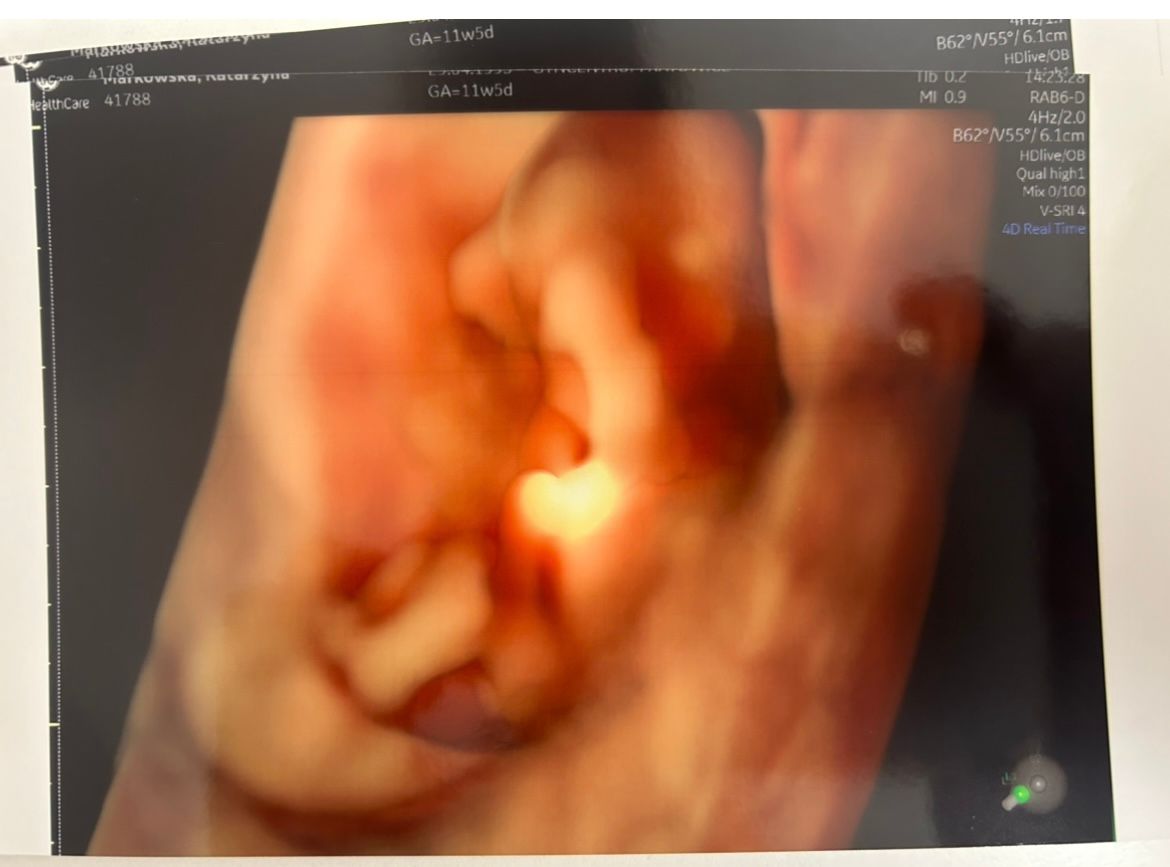 Wioletta Rozmus-Warcholińska-120