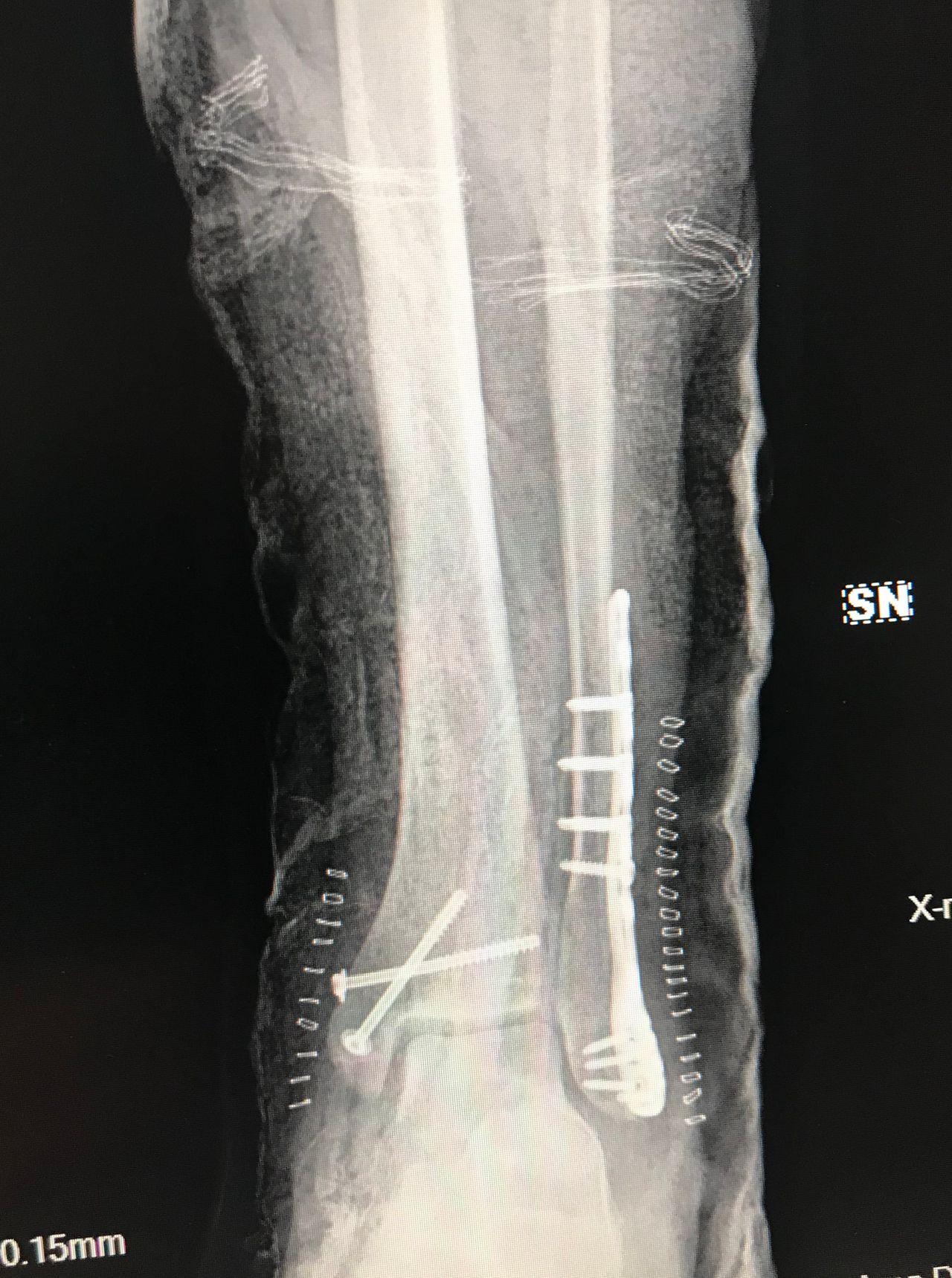 Alberto Maria Bonifazi-5