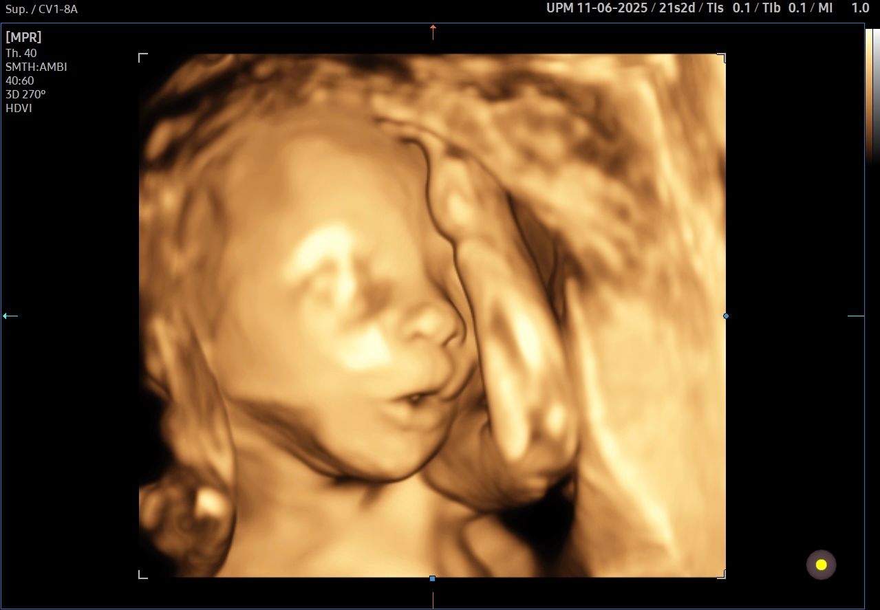 Valentina Del Negro-7