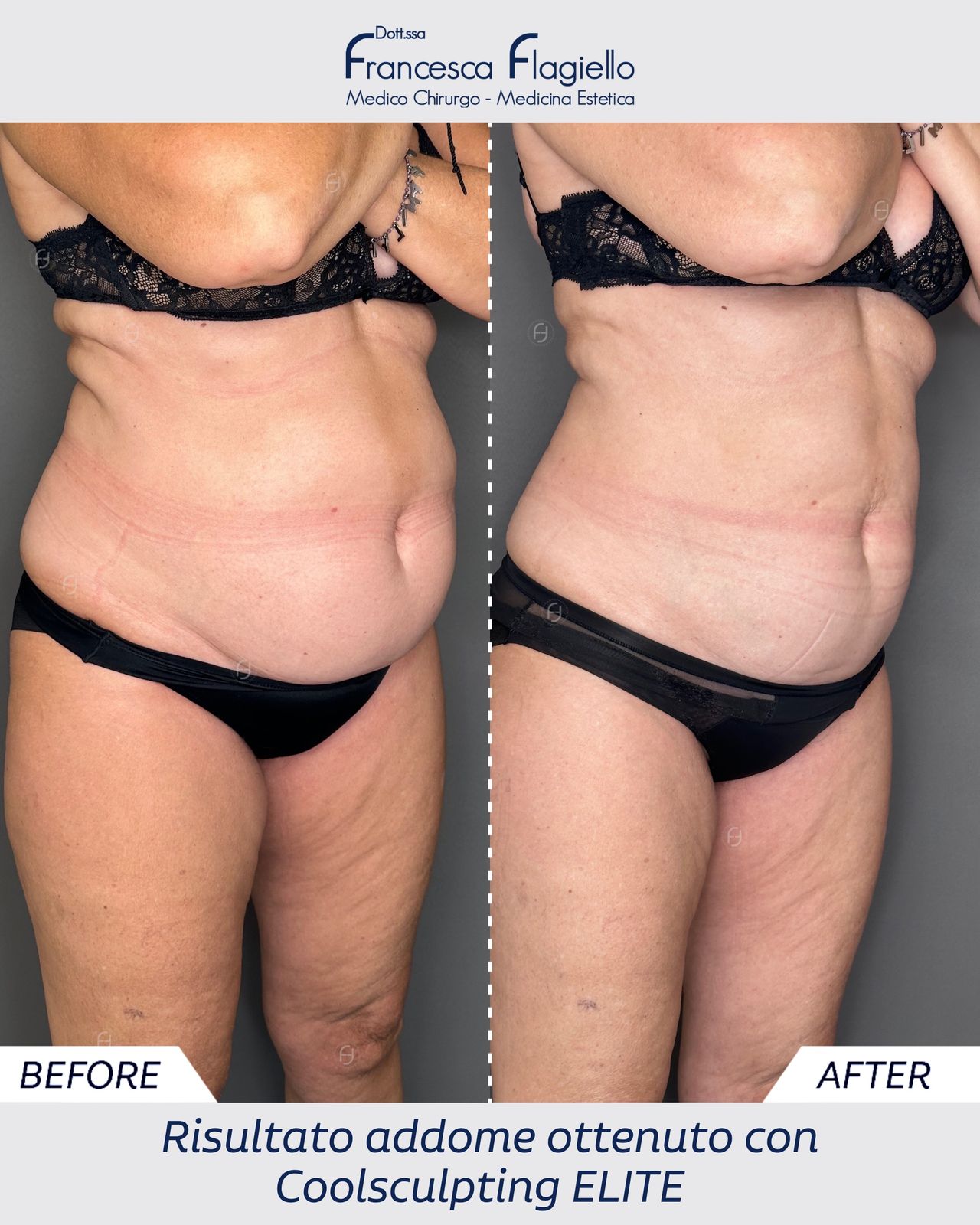 Francesca Flagiello-25