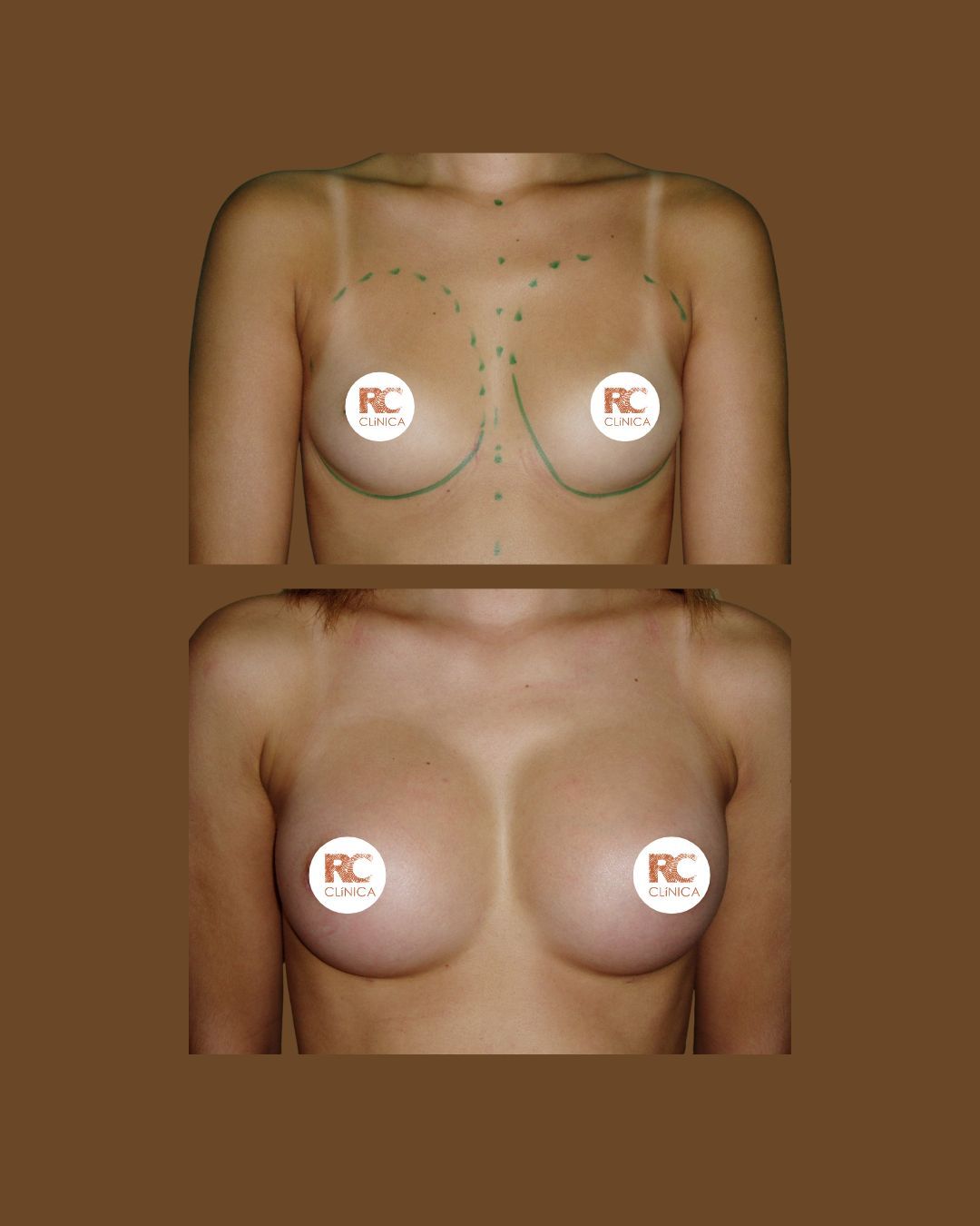 Roy Camacho Ramirez-7