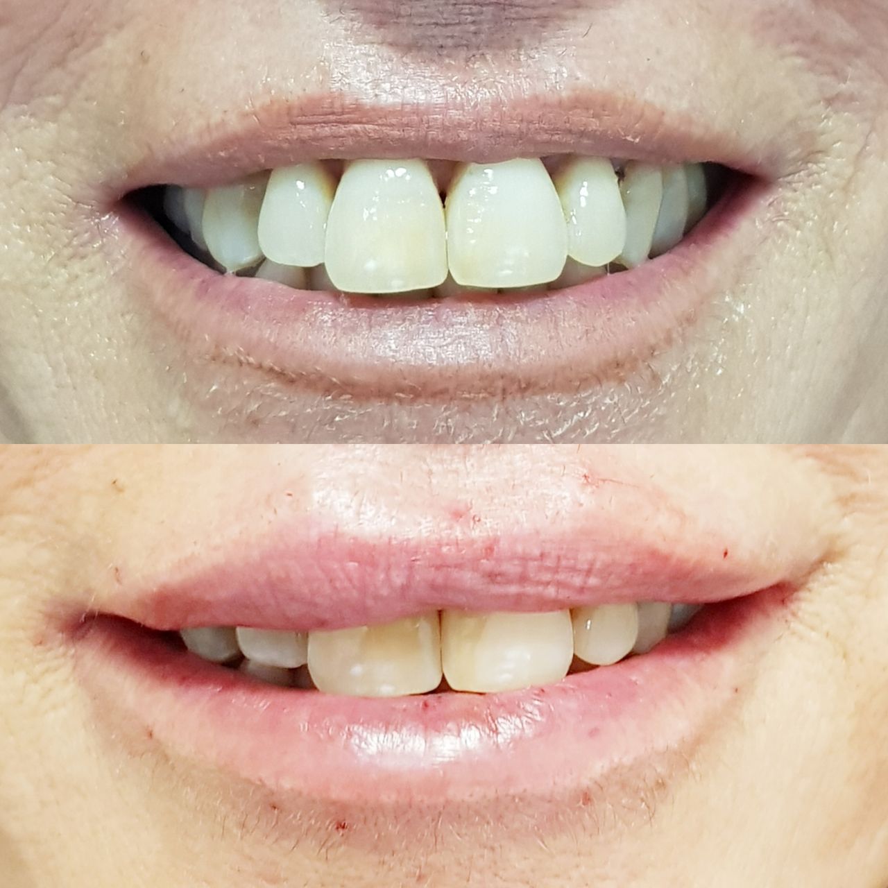 Rosalba Herrero Zerpa-283