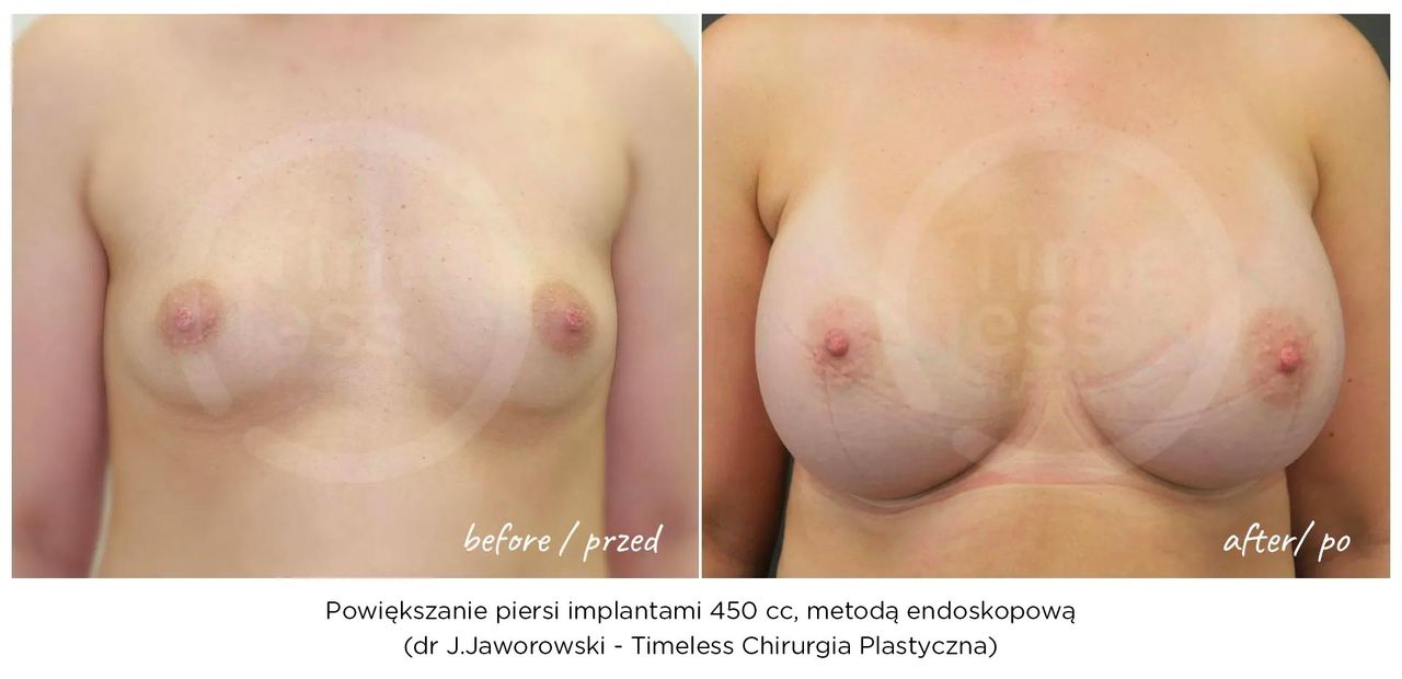 Janusz Jaworowski-100