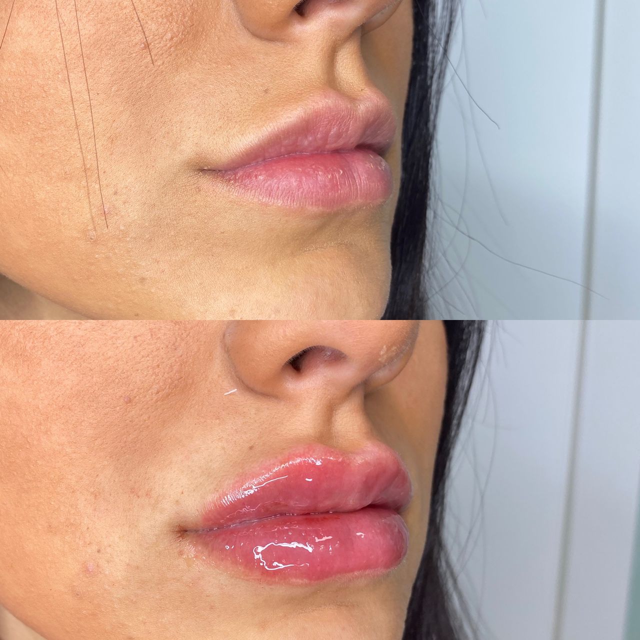 Antonio Napoletano-3