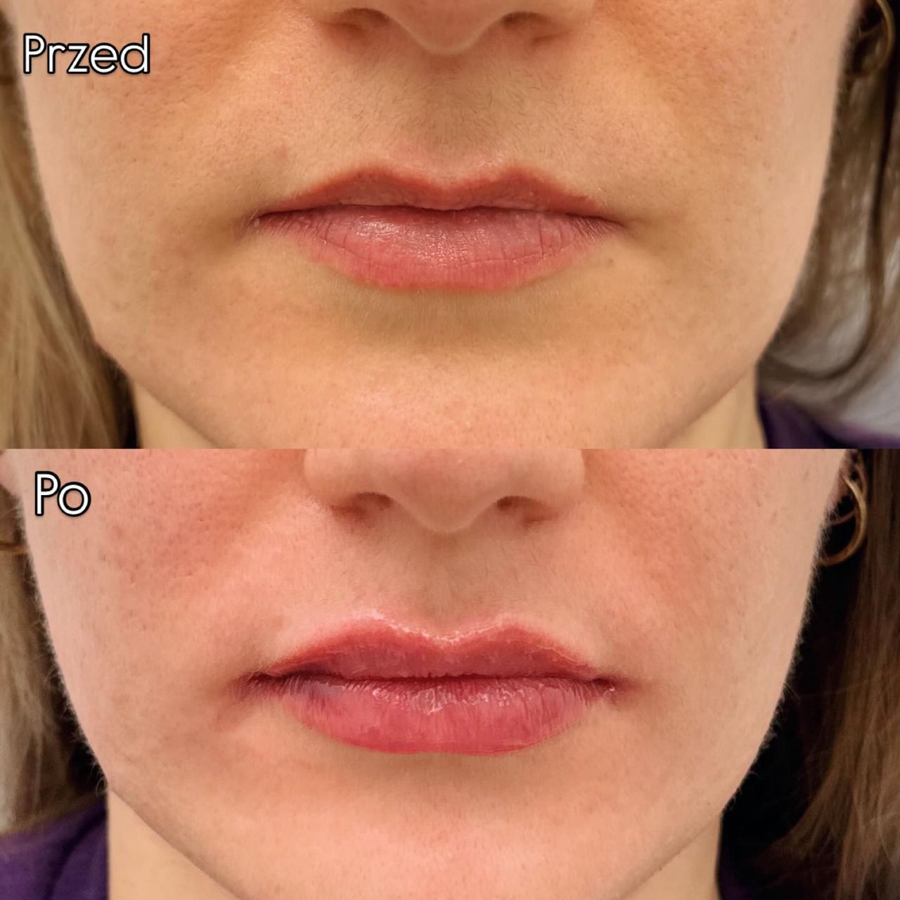 Aleksandra Kowalczuk-29