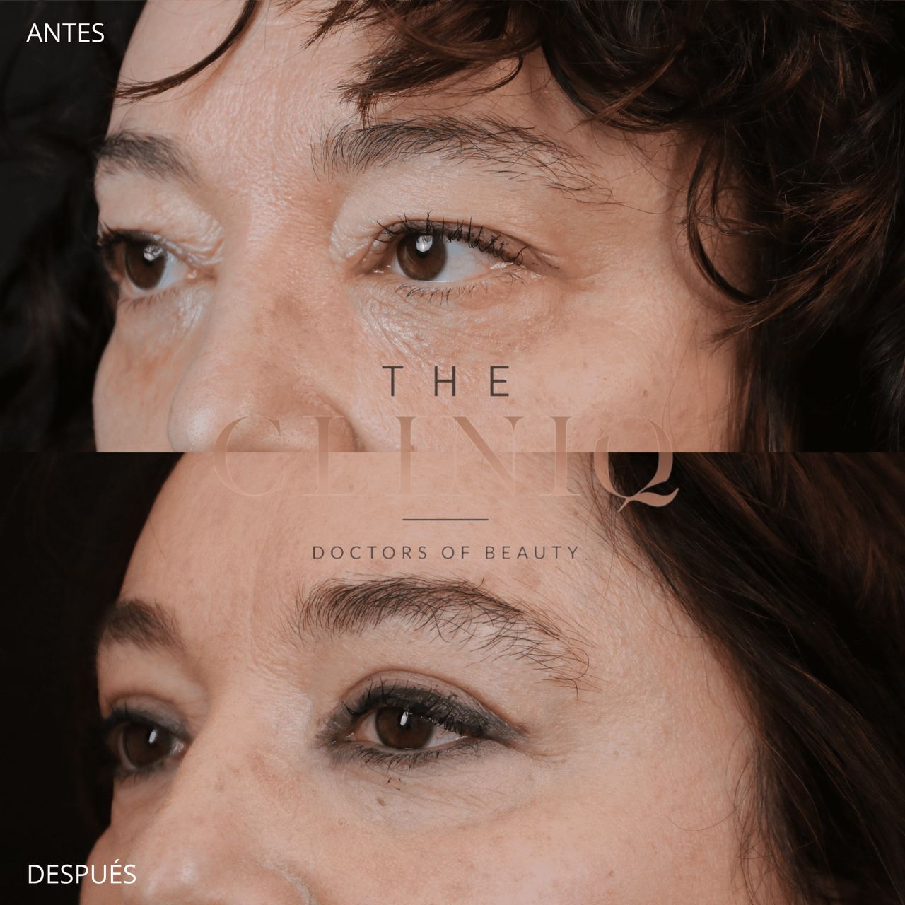 Ignacio Genol Saavedra-12