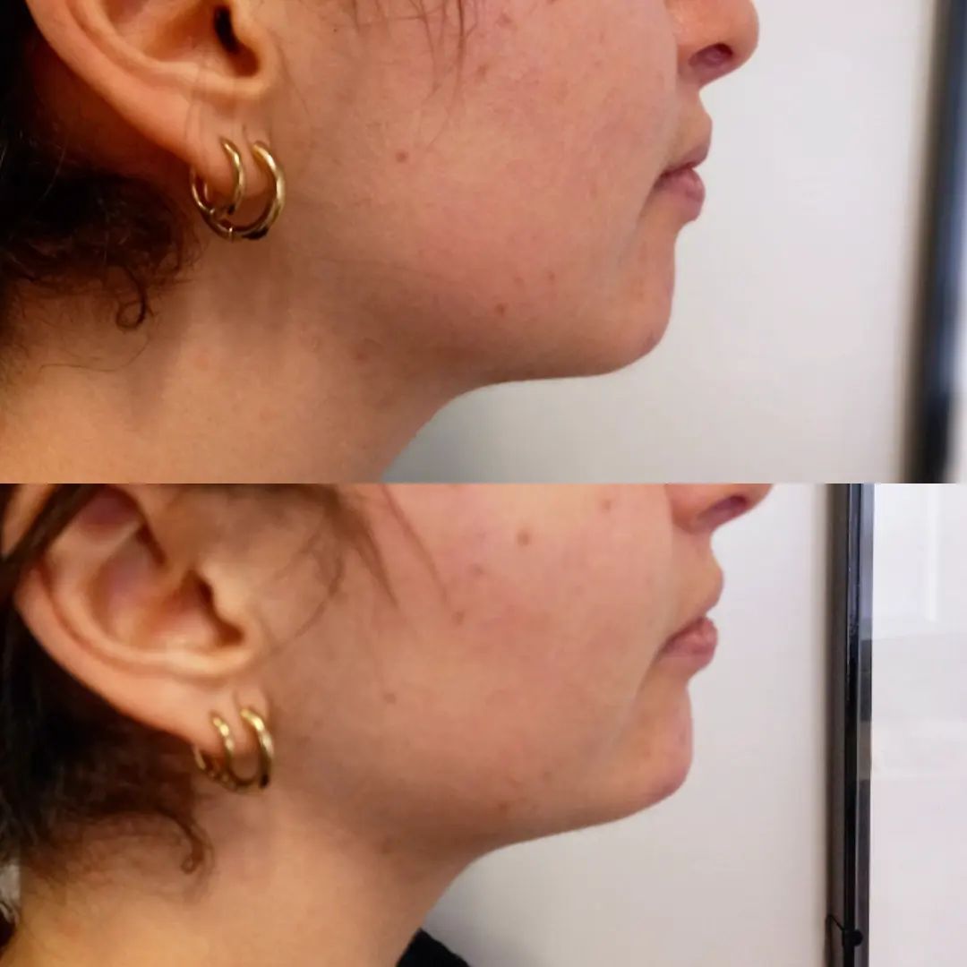 Giovanni Benfenati-6