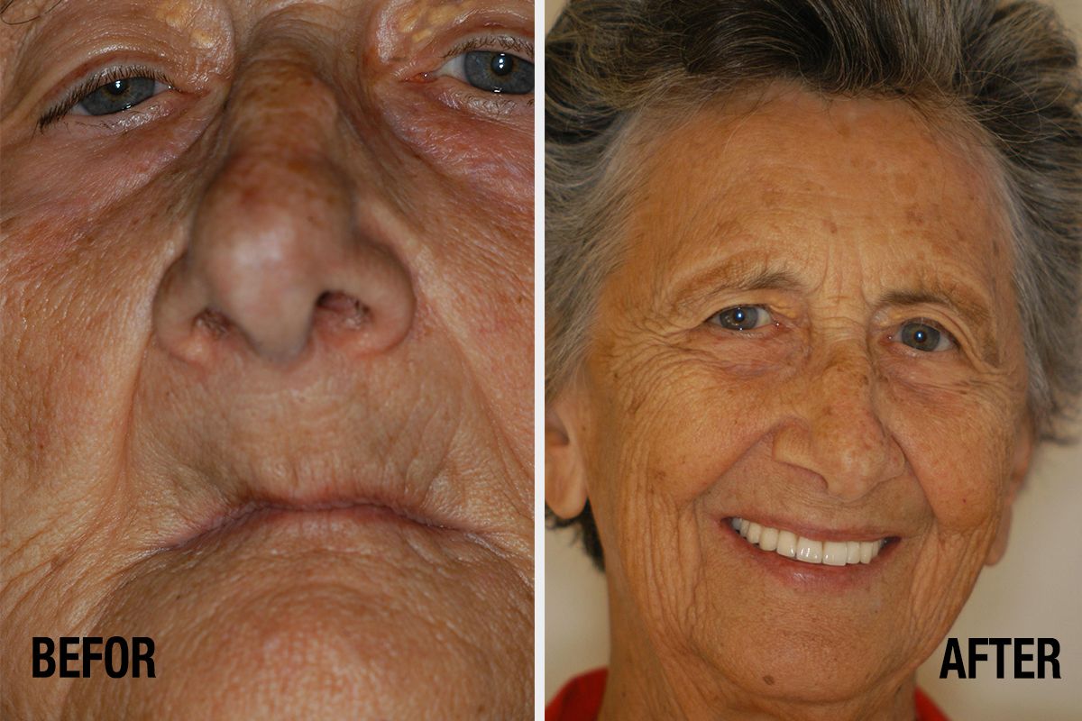 Alessandro Palumbo-38