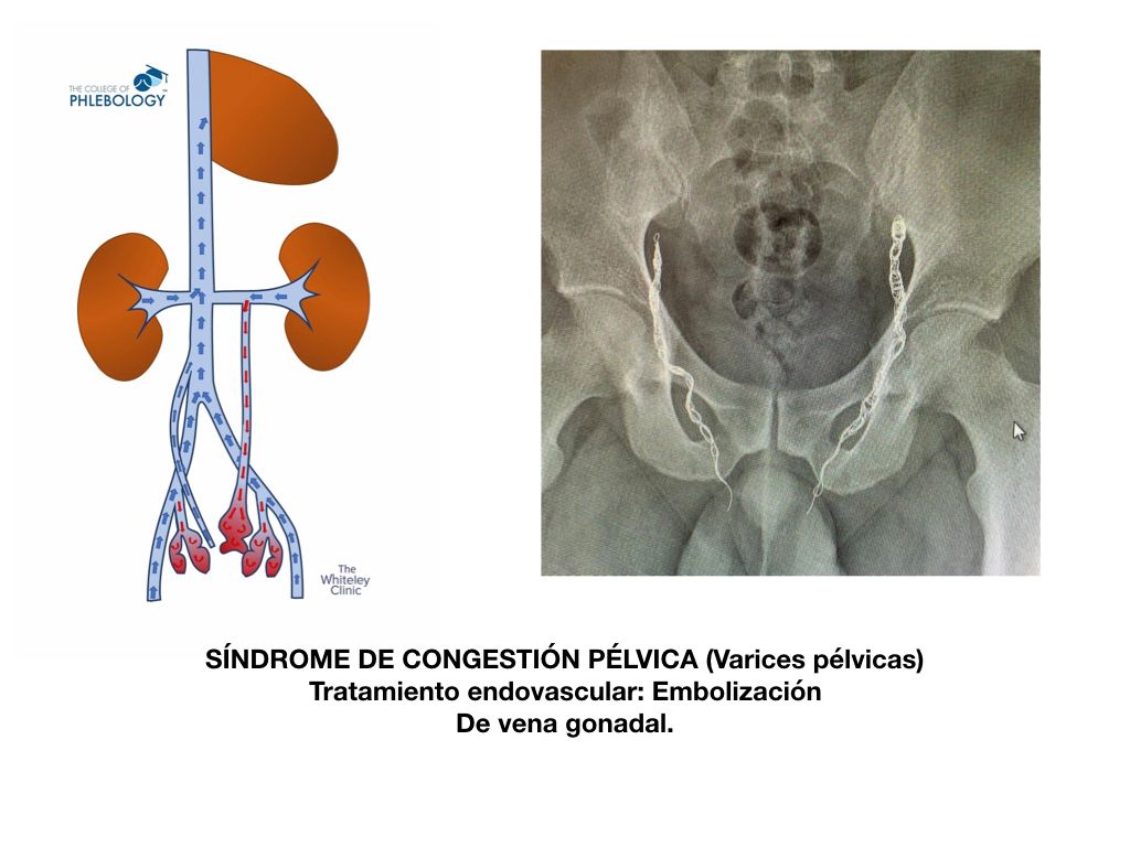 Maria Isabel Lara Guerrero-6