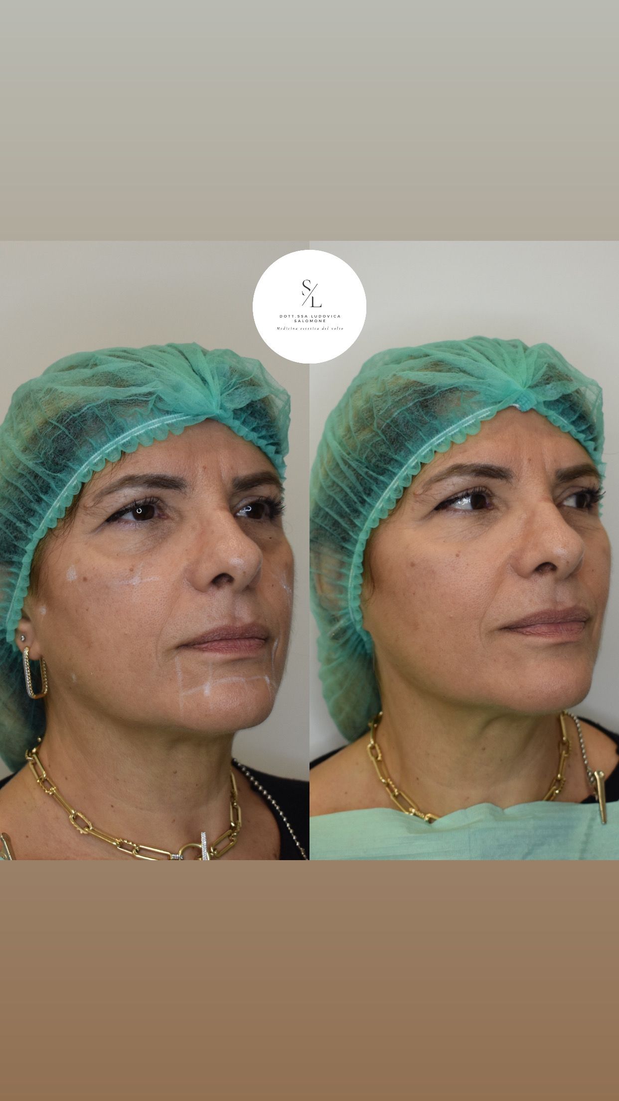 Ludovica Salomone-10