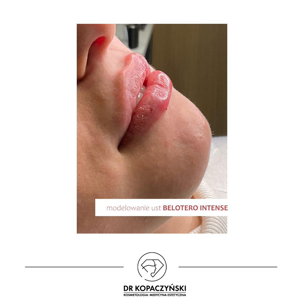 Jakub Kopaczyński-3