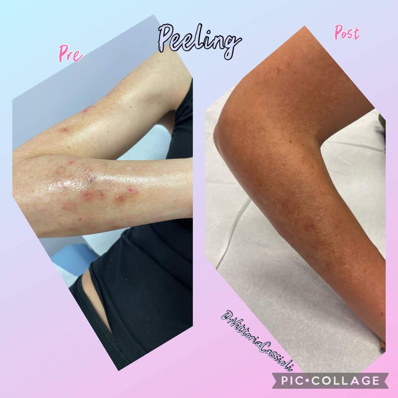 Vittoria Cassioli-74