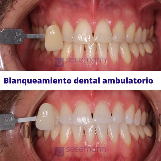 Paula Cano Carrillo-65