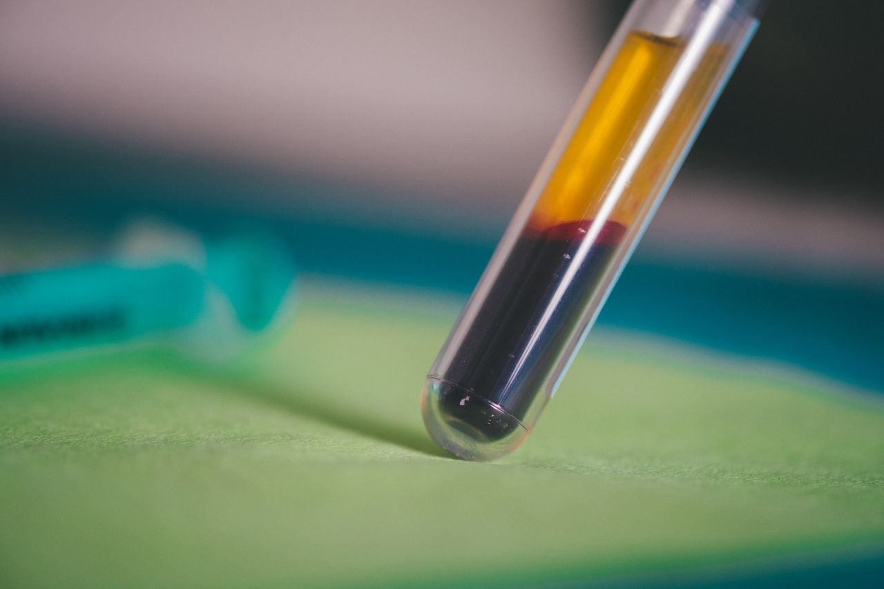 Alberto Caro Centeno-13