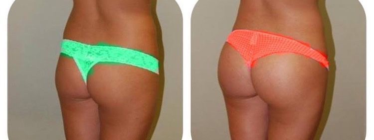 Pasquale Virciglio-21