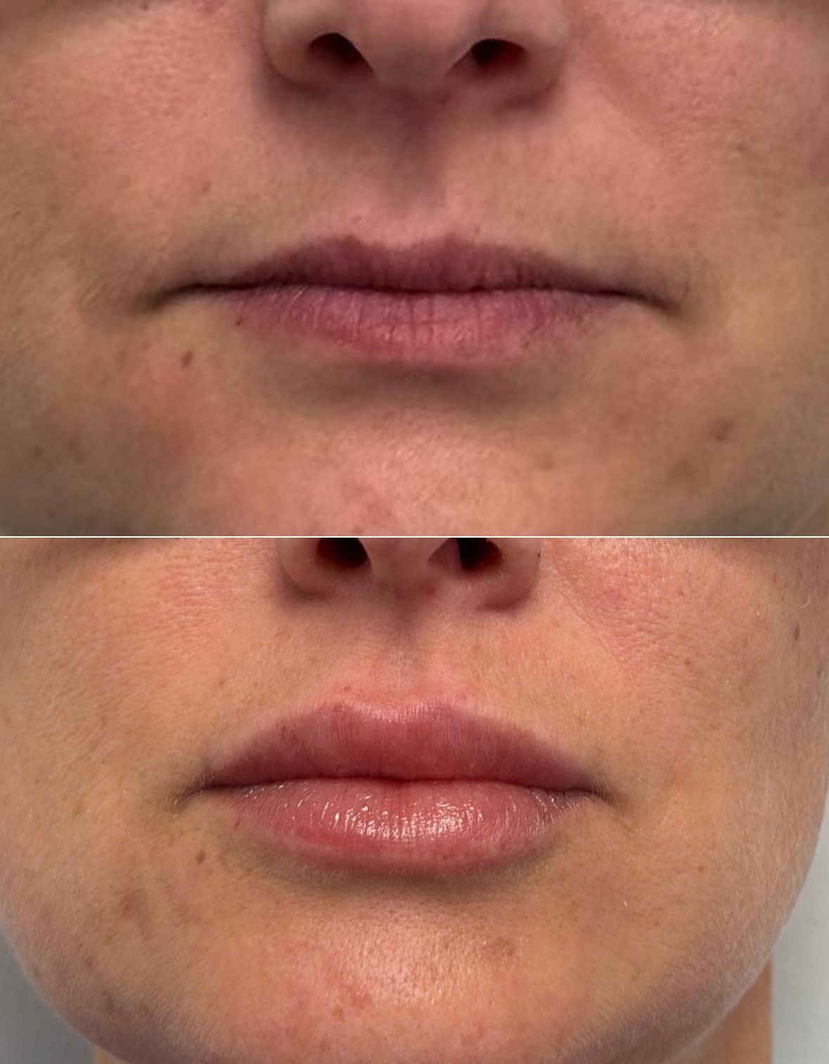 Medicina Estetica Bernini-0