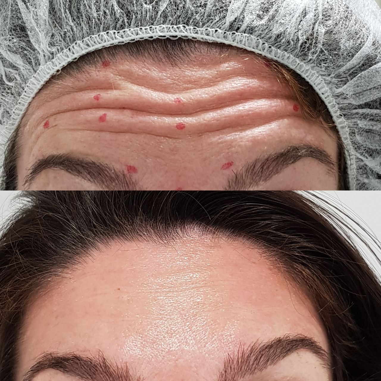 Rosalba Herrero Zerpa-309