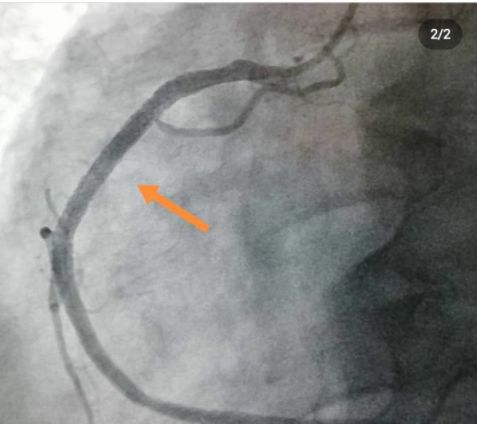 Hüseyin Onur Şahin-14