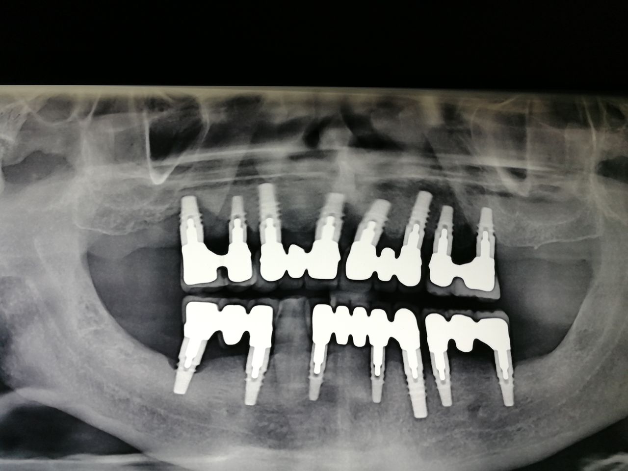 Alessandro Neglia-11