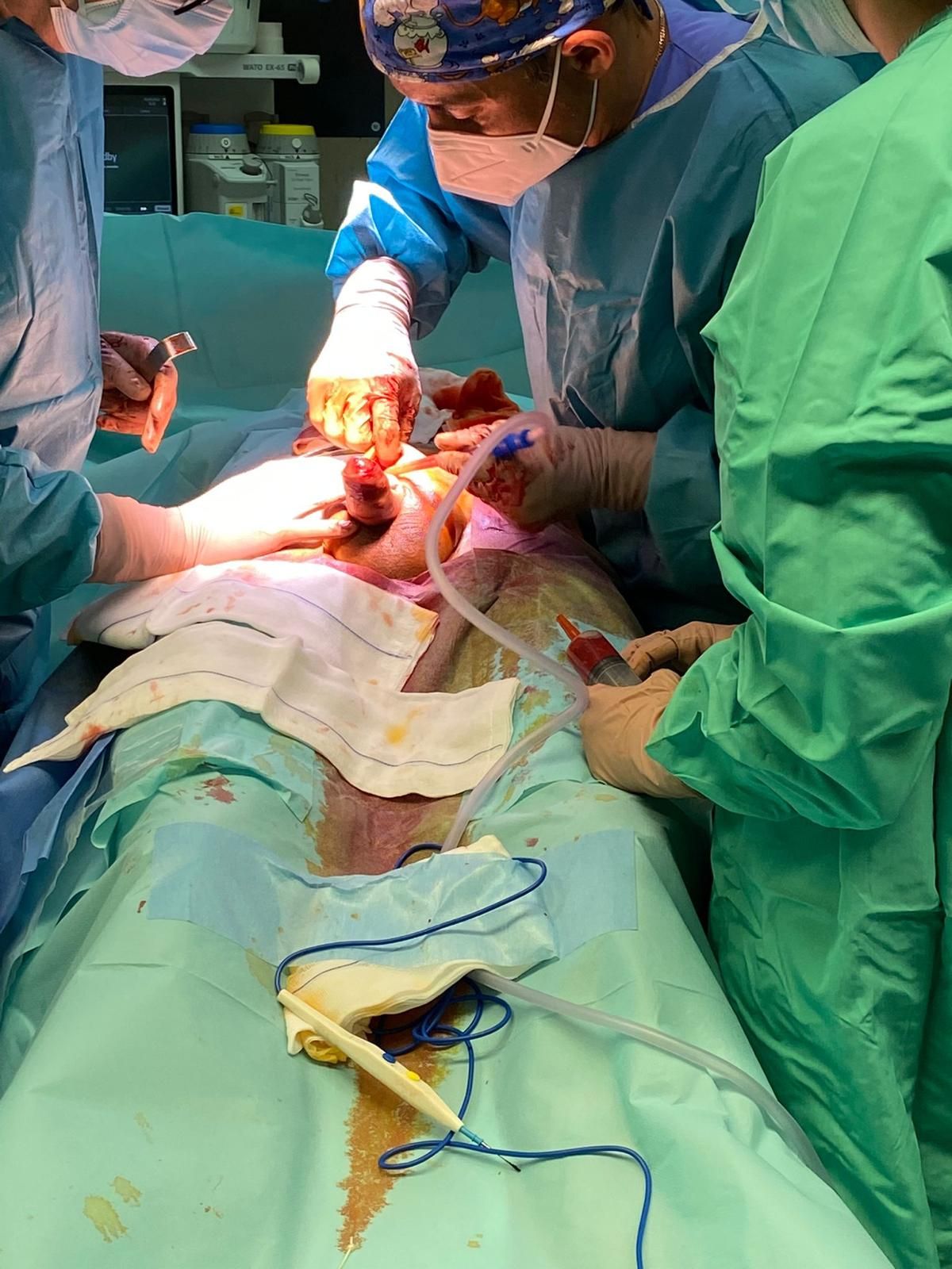 Luis Fernando Susaníbar Napurí-4