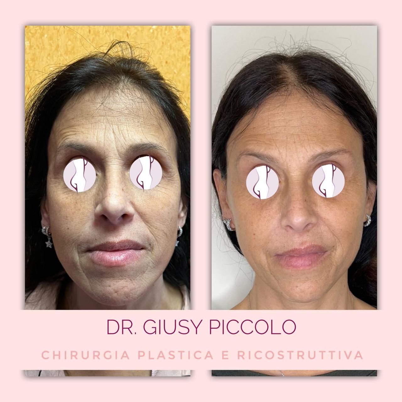 Giuseppina Piccolo-10