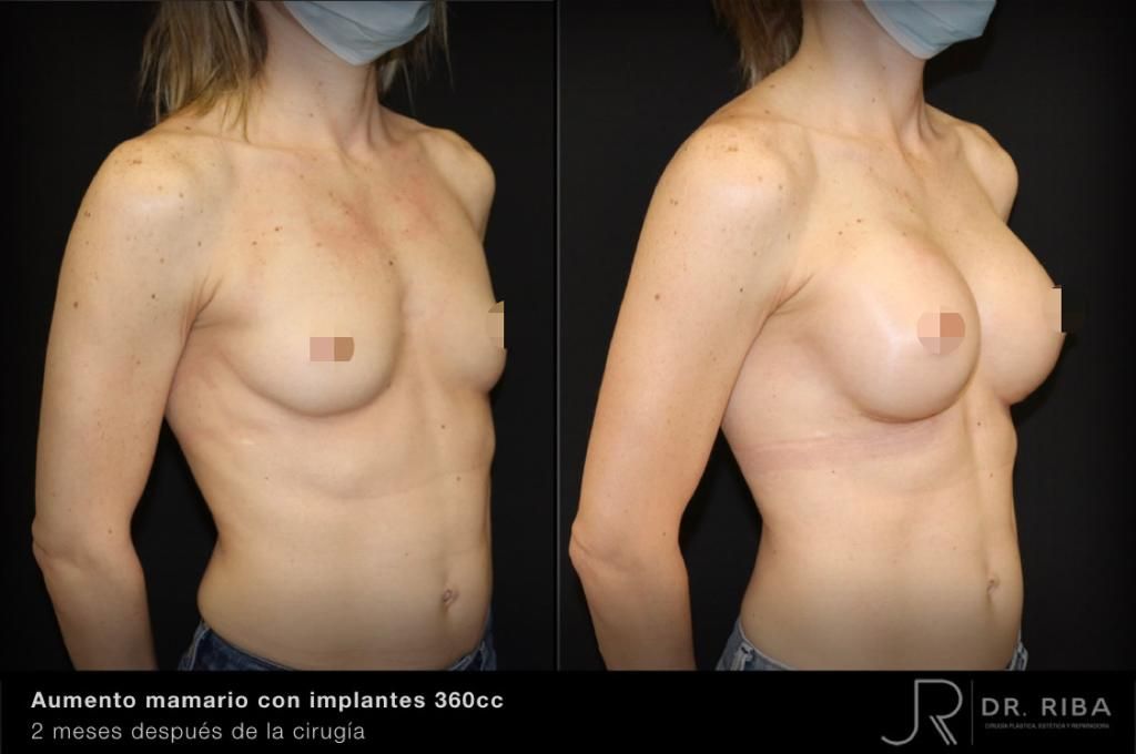 Jordi Riba Vilchez-14