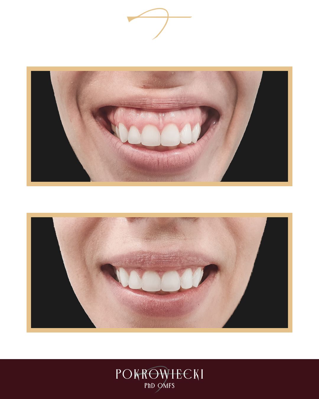 Rafał Pokrowiecki-39