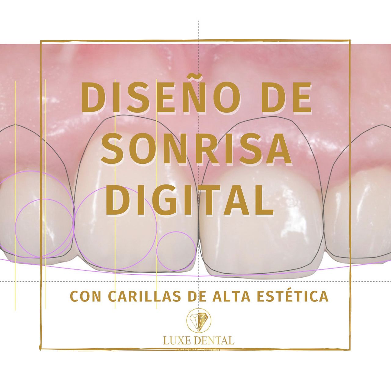 Ruben Patier Martin-8