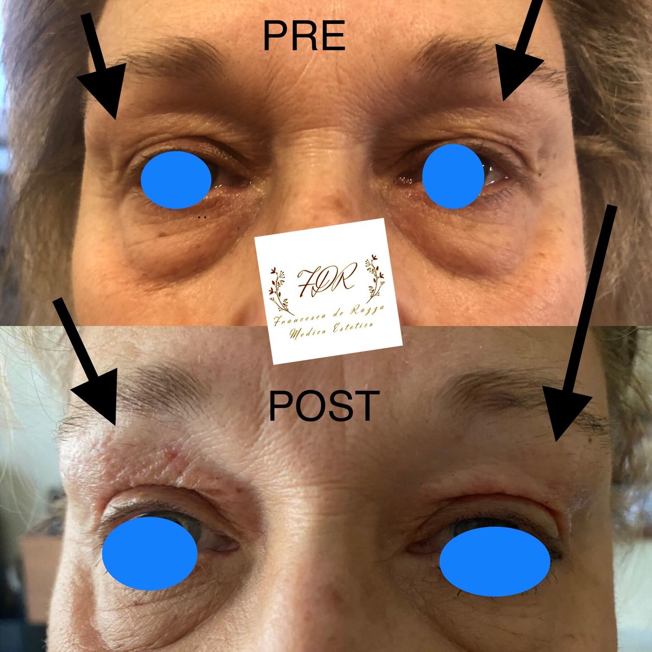 Francesca De Razza-32