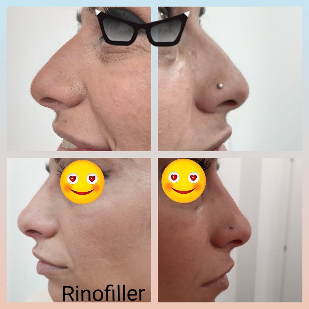 Paola Della Rocca-13