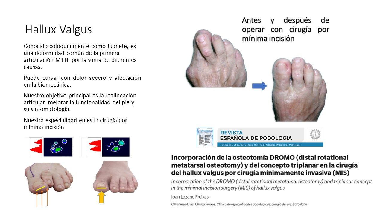 Joan Lozano Freixas-7