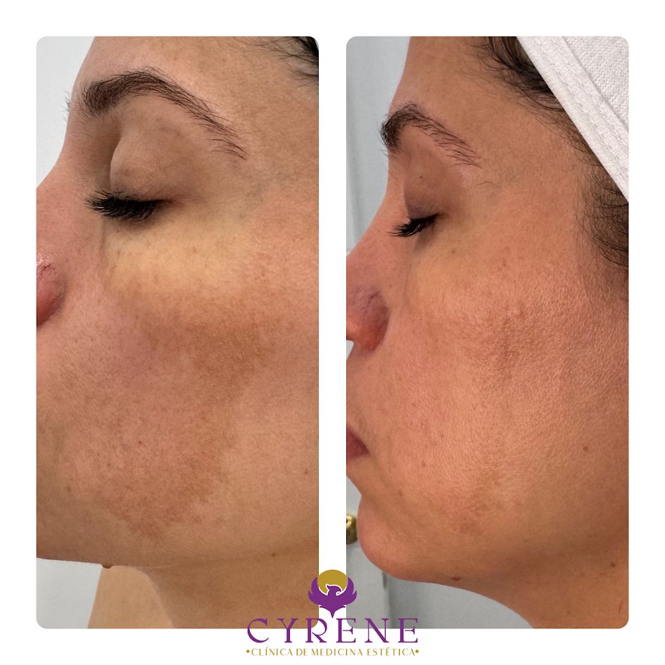 Yolimar Acevedo Raya-3