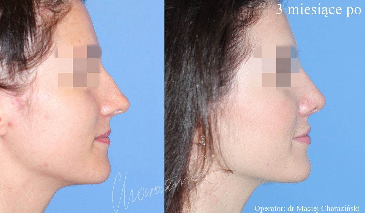 Maciej Charaziński-58